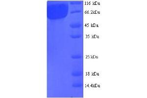 SDS-PAGE (SDS) image for AGALB (AA 21-443) protein (His tag) (ABIN5714250) (AGALB (AA 21-443) protein (His tag))