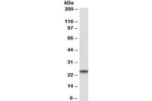 Western blot testing of human testis lysate with RAN antibody at 1ug/ml. (RAN antibody)