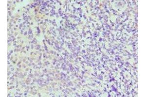 Immunohistochemistry of paraffin-embedded human tonsil tissue using ABIN7156622 at dilution of 1:100 (IRF4 antibody  (AA 180-451))