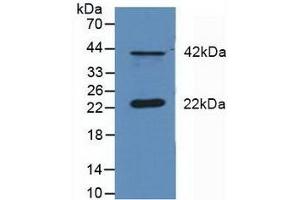 Detection of DUSP6 in Mouse Cerebellum Tissue using Polyclonal Antibody to Dual Specificity Phosphatase 6 (DUSP6) (DUSP6 antibody  (AA 1-300))