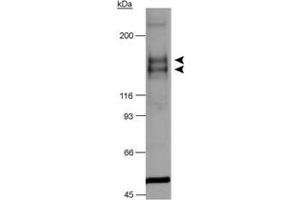 Western blot analysis of Flt1 in chimeric CSF-1R/VEGFR-2 detection in transfected lysates using Flt1 polyclonal antibody . (FLT1 antibody  (AA 800-900))
