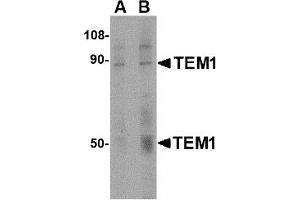 Western Blotting (WB) image for anti-CD248 Molecule, Endosialin (CD248) (C-Term) antibody (ABIN1030727) (CD248 antibody  (C-Term))