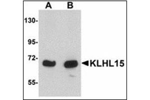 Western blot analysis of KLHL15 in HeLa cell lysate with KLHL15 antibody at (A) 1 and (B) 2 µg/ml.