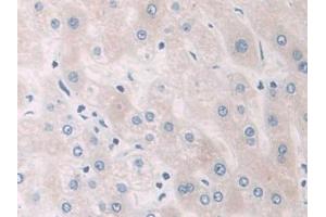 Immunohistochemistry (IHC) image for anti-phosphorylase, Glycogen, Brain (GPBB) (AA 477-731) antibody (ABIN7439942)