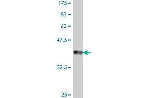 Western Blot detection against Immunogen (38. (GSPT1 antibody  (AA 390-499))