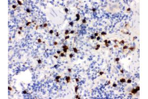 Anti- S100A9 Picoband antibody, IHC(P) IHC(P): Rat Spleen Tissue (S100A9 antibody  (AA 2-113))