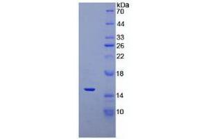 SDS-PAGE analysis of recombinant Human DEFa5.