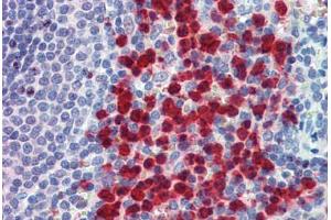 Human Spleen: Formalin-Fixed, Paraffin-Embedded (FFPE) (Cell Adhesion Molecule 4 antibody  (AA 370-384))