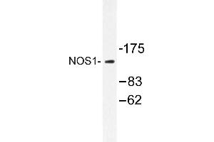 Image no. 1 for anti-Nitric Oxide Synthase 1, Neuronal (NOS1) antibody (ABIN272121) (NOS1 antibody)