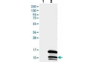 Western blot analysis of Lane 1: Negative control (vector only transfected HEK293T lysate), Lane 2: Over-expression Lysate (Co-expressed with a C-terminal myc-DDK tag (~3. (CCDC23 antibody)