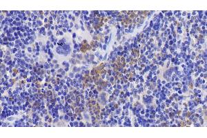Immunohistochemistry (IHC) image for anti-Cyclin-Dependent Kinase 2 (CDK2) (AA 5-346) antibody (ABIN7437293)