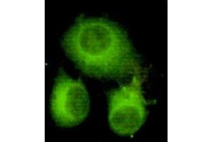 Immunocytochemistry of HeLa cells using anti-ATP-Citrate Lyase (C-terminus) mouse mAb diluted 1:150. (ACLY antibody  (C-Term))