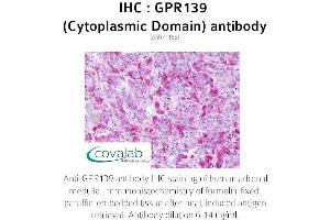 Image no. 2 for anti-G Protein-Coupled Receptor 139 (GPR139) (3rd Cytoplasmic Domain) antibody (ABIN1734944)