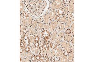 Immunohistochemical analysis of paraffin-embedded human kidney tissue using B performed on the Leica® BOND RXm. (ABCF1 antibody  (C-Term))