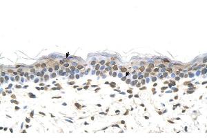 Rabbit Anti-FTCD Antibody ,Paraffin Embedded Tissue: Human Skin  Cellular Data: Squamous epithelial cells  Antibody Concentration: 4. (FTCD antibody  (N-Term))