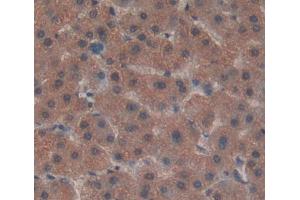 IHC-P analysis of liver tissue, with DAB staining. (ADAMTS13 antibody  (AA 682-859))