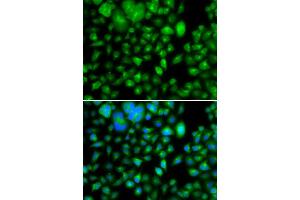 Immunofluorescence analysis of A549 cell using METTL7B antibody.