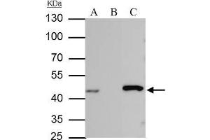IP Image IDH-1 antibody immunoprecipitates IDH-1 protein in IP experiments. (IDH1 antibody  (Center))