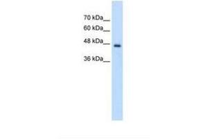 Image no. 1 for anti-Phosphate Cytidylyltransferase 2, Ethanolamine (PCYT2) (AA 301-350) antibody (ABIN320808) (PCYT2 antibody  (AA 301-350))