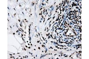 Image no. 6 for anti-Replication Protein A2, 32kDa (RPA2) antibody (ABIN1500733)