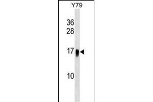UBE2G1 Antibody (C-term) (ABIN1536693 and ABIN2848805) western blot analysis in Y79 cell line lysates (35 μg/lane). (UBE2G1 antibody  (C-Term))
