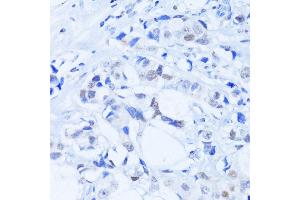 Immunohistochemistry (Paraffin-embedded Sections) (IHC (p)) image for anti-Poly (ADP-Ribose) Polymerase 1 (PARP1) (AA 81-390) antibody (ABIN6145232)
