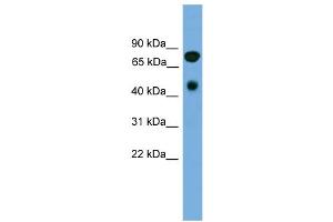WB Suggested Anti-RIPK4 Antibody Titration:  0. (RIPK4 antibody  (N-Term))