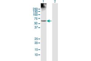 Western Blot analysis of ACCS expression in transfected 293T cell line by ACCS MaxPab polyclonal antibody. (PHACS antibody  (AA 1-501))