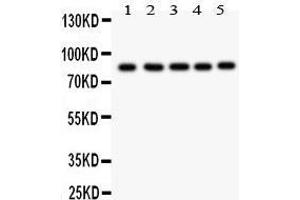 Anti- FOXM1 antibody, Western blotting All lanes: Anti FOXM1  at 0. (FOXM1 antibody  (AA 411-763))