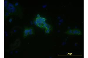 Immunofluorescence of monoclonal antibody to MCAM on JEG-3 cell .