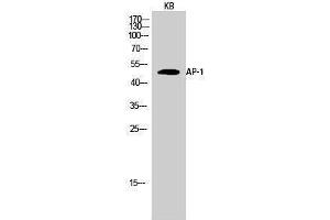 Western Blotting (WB) image for anti-Jun Proto-Oncogene (JUN) (Ser661) antibody (ABIN3183303) (C-JUN antibody  (Ser661))
