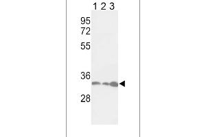 Western blot analysis of PCNA Antibody (Center) (ABIN389345 and ABIN2839454) in Jurkat(lane 1), Hela(lane 2), 293(lane 3) cell line lysates (35 μg/lane). (PCNA antibody  (AA 89-117))