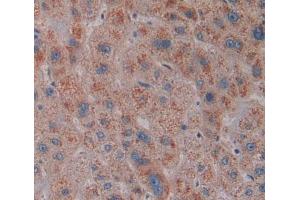 #VALUE! (Squamous Cell Carcinoma Antigen 1/2 (AA 211-390) antibody)