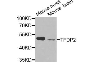Western blot analysis of extracts of various cell lines, using TFDP2 antibody (ABIN5972290) at 1/1000 dilution. (DP2 antibody)