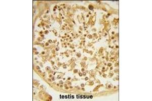 Formalin-fixed and paraffin-embedded human testis tissue reacted with DZIP1 Antibody (Center), which was peroxidase-conjugated to the secondary antibody, followed by DAB staining. (DZIP1 antibody  (AA 568-596))