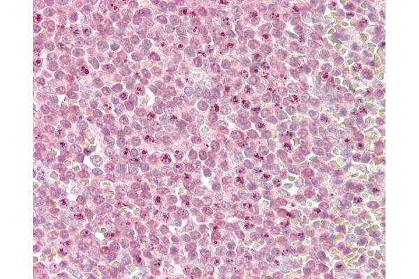 MLL2 antibody  (AA 2-14)