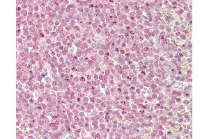 Anti-MLL2 antibody IHC of human spleen. (MLL2 antibody  (AA 2-14))