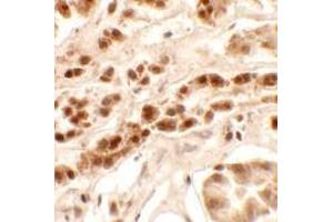 Immunohistochemistry of PTCHD2 in human kidney tissue with PTCHD2 Cat. (PTCHD2 antibody  (Middle Region))