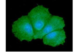 ICC/IF analysis of GALE in Hep3B cells line, stained with DAPI (Blue) for nucleus staining and monoclonal anti-human GALE antibody (1:100) with goat anti-mouse IgG-Alexa fluor 488 conjugate (Green). (GALE antibody  (AA 1-348))
