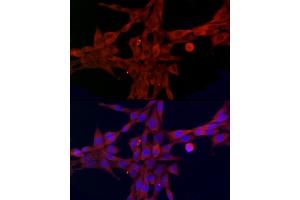 Immunofluorescence analysis of NIH/3T3 cells using SLC27 Rabbit pAb (2847) at dilution of 1:100 (40x lens). (SLC27A1 antibody  (AA 347-646))