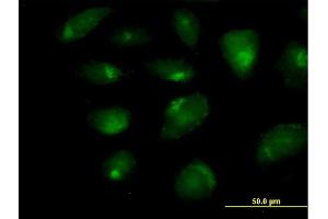 Immunofluorescence of purified MaxPab antibody to CARD9 on HeLa cell. (CARD9 antibody  (AA 1-492))