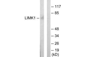 Western Blotting (WB) image for anti-LIM Domain Kinase 1 (LIMK1) (Internal Region) antibody (ABIN1849454) (LIM Domain Kinase 1 antibody  (Internal Region))
