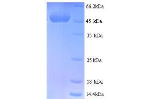 SDS-PAGE (SDS) image for Cysteine-Rich, Angiogenic Inducer, 61 (CYR61) (AA 25-379) protein (His tag) (ABIN4976833)