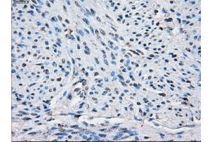Immunohistochemical staining of paraffin-embedded endometrium tissue using anti-PPP5Cmouse monoclonal antibody. (PP5 antibody)