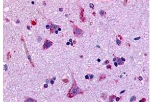 Immunohistochemistry (Formalin/PFA-fixed paraffin-embedded sections) of human brain, neurons and glia with GPR45 polyclonal antibody . (GPR45 antibody  (Extracellular Domain))