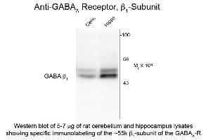 Western Blot of Anti-GABA(A) Receptor beta 1 (Rabbit) Antibody - 612-401-D49 Western Blot of Rabbit anti-GABA(A) Receptor beta 1 antibody. (GABRB1 antibody  (Cytoplasmic Loop))