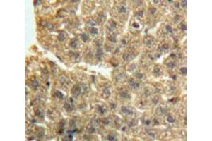 Used in DAB staining on fromalin fixed paraffin-embedded Liver tissue (GDF2 antibody  (AA 241-418))
