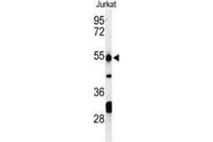 Western blot analysis of PRUNE (arrow) in Jurkat cell line lysates (35ug/lane) using PRUNE  Antibody (C-term).