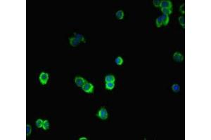 Immunofluorescence (IF) image for anti-SMAD, Mothers Against DPP Homolog 2 (SMAD2) (AA 2-467) antibody (ABIN7160228)