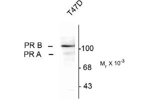 Western blots of whole cell T47D lysate prepared from cells that had been incubated in the presence of the synthetic progestin agonist R5020 (500 nM) showing specific immunolabeling of the ~90k PR-A isoform and the ~120 PR-B isoform of the progesterone receptor phosphorylated at Ser294. (Progesterone Receptor antibody  (pSer294))